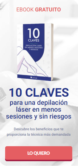 ¿Cuál es el mejor láser para la depilación permanente? | Corporación Capilar